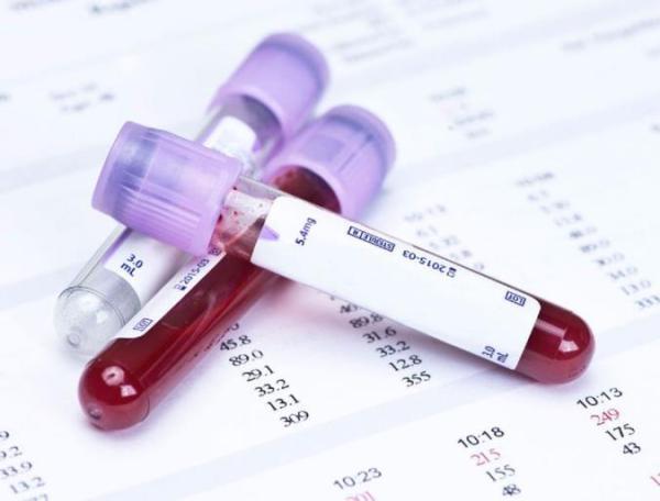 تشخیص سرطان خون به وسیله آزمایش خون و تفسیر آن